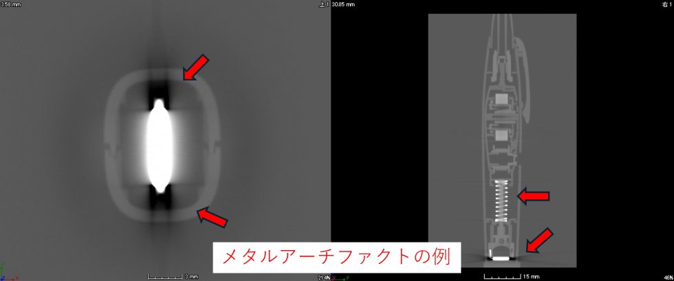 メタルアーチファクト